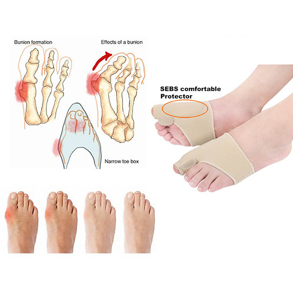 новый массаж ног большой палец защита носилки